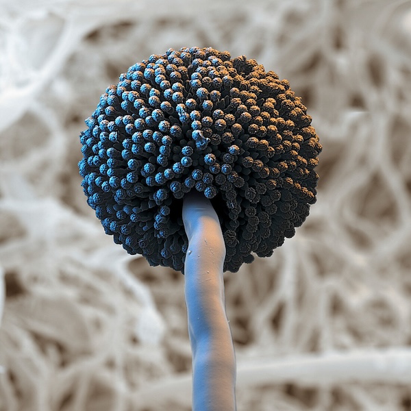 Sử dụng nấm Aspergillus niger trong quy trình sản xuất Acid Citric